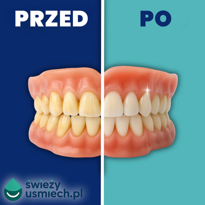 SoniDent – Ultradźwiękowy czyścik do protez